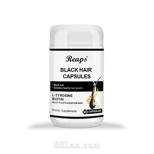 �ڷ����� ����˿ �ػ��ں�